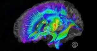 immagine digitale a colori del cervello umano